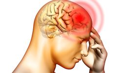 Beyin kanaması neden olur? Beyin kanaması nasıl önlenir?
