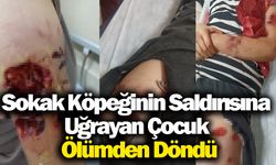 Sokak Köpeğinin Saldırısına Uğrayan Çocuk Ölümden Döndü