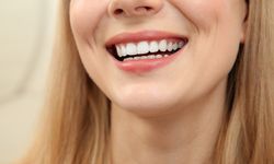 Beyaz Diş Hayali, Dişsiz Kalma Kâbusuna Dönüşmesin! Uzmanlar Uyarıyor: "Denemeyin!"
