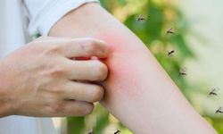 Küresel Isınma Sivrisinek Sayısını Arttırıyor! Bu Yaz Herkes Bunlara Dikkat Etmek Zorunda