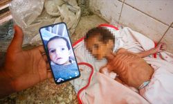 3 Aylık Bebek Açlıktan Hayatını Kaybetti