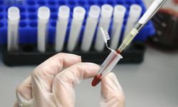 HIV Virüsü Artık Saklanamayacak!