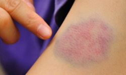 Morarma Ciddi Hastalık Habercisi Olabilir!