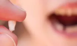 Rüyada Diş Düşmesi Ne Anlama Gelir?