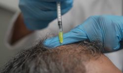 Saç Dökülmesi Vücudun Sessiz Çığlığı Olabilir