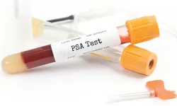 50 Yaş Üstü Erkeklere Prostat Uyarısı