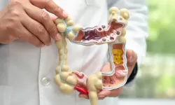 Bağırsak Hastalıkları Ciddi Riskler Taşıyor