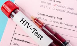 HIV Uyarısı: Erken Tanı Yaşam Kurtarıyor