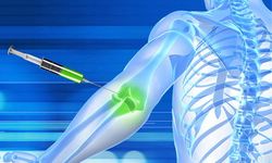 Kas-İskelet Ağrılarında Proloterapi İlgi Görüyor