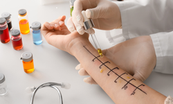 Alerji Testi için Panel Sayısı Arttıkça Maliyet Nasıl Değişir?