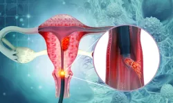 Serviks Kanseri İçin Hayati Çağrı