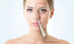 Uzmanından Cilt Yenileme Uyarısı