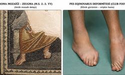 Zeugma mozaiğinde dikkat çeken anatomik detay