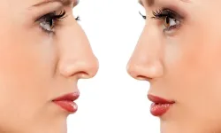 Estetik cerrahide doğal görünüm mümkün mü?