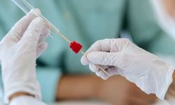 Akciğer hastalıklarında umut veren idrar testi