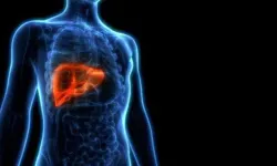 Karaciğerdeki tümör başka bir organdan kaynaklanabilir