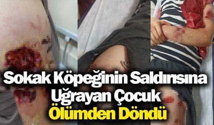 Sokak Köpeğinin Saldırısına Uğrayan Çocuk Ölümden Döndü