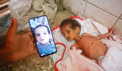 3 Aylık Bebek Açlıktan Hayatını Kaybetti