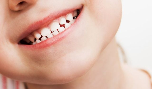 Çocuklarda Diş Çürüğü: Görmezden Gelmemeniz Gereken Şeyler!