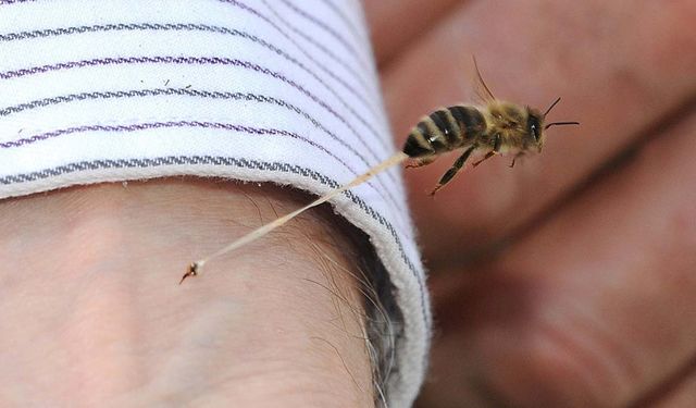 Arı Sokması: Kaşıntıyı ve Şişliği Gidermenin En İyi Yolları