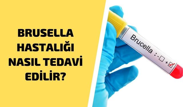 Brusella Nedir? Belirtileri Hakkında Bilmeniz Gerekenler