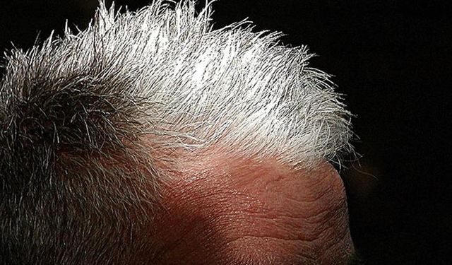 Beyaz Saçları Doğal Yollarla 1 Saatte Kapatan Yöntem!