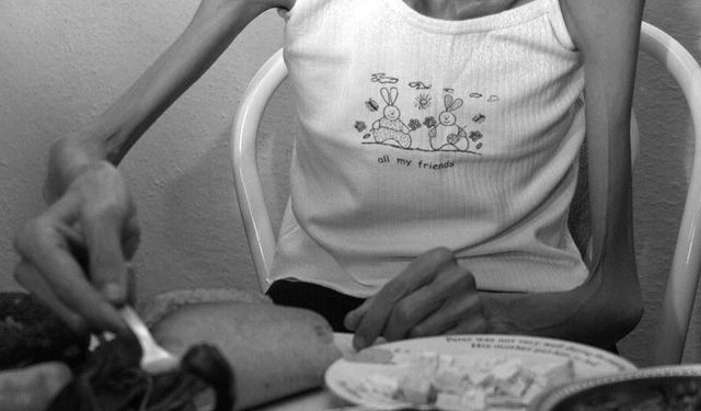 Anoreksiya Nervoza Nedir ve Nasıl Tedavi Edilir?