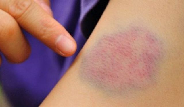 Morarma Ciddi Hastalık Habercisi Olabilir!