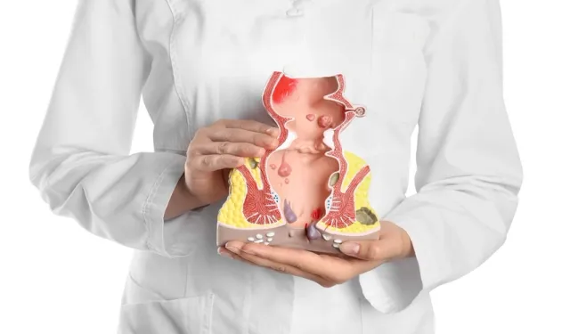 Makat Çatlağı Nedir? Belirtileri Nelerdir?