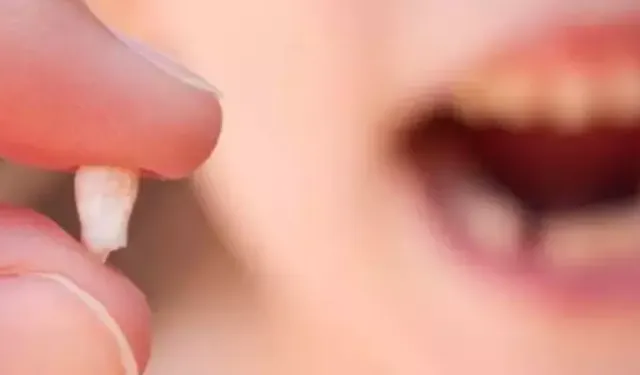 Rüyada Diş Düşmesi Ne Anlama Gelir?