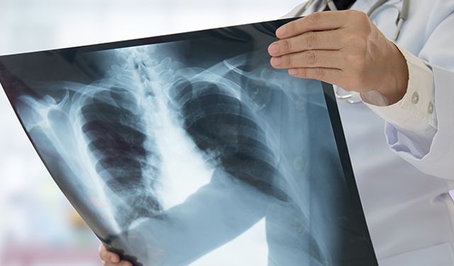 Zatürre Basit Bir Hastalık Değil