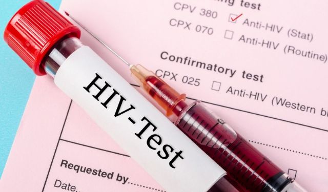 HIV Uyarısı: Erken Tanı Yaşam Kurtarıyor
