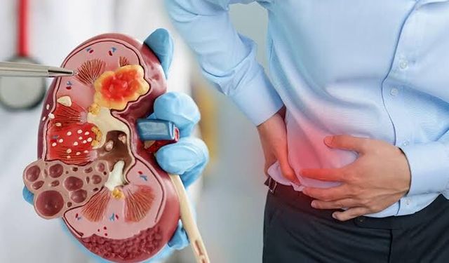 Sıcaklar Böbrekleri Vuruyor: Her 10 Kişiden Biri Risk Altında