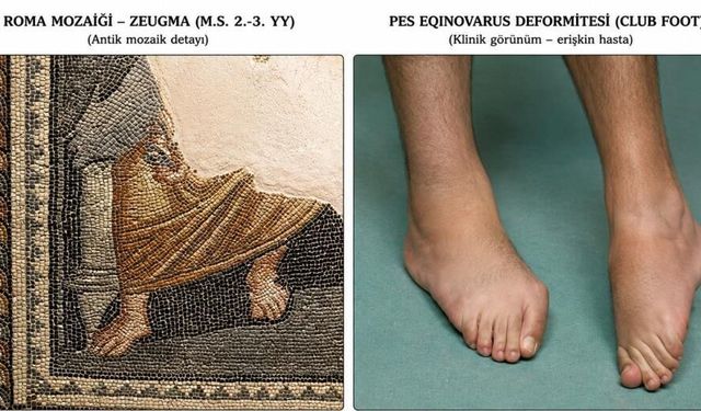 Zeugma mozaiğinde dikkat çeken anatomik detay