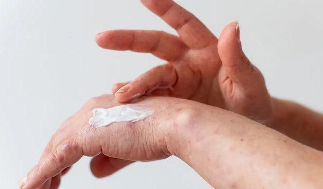 Kuru ve çatlayan eller için 3 pratik bakım yöntemi