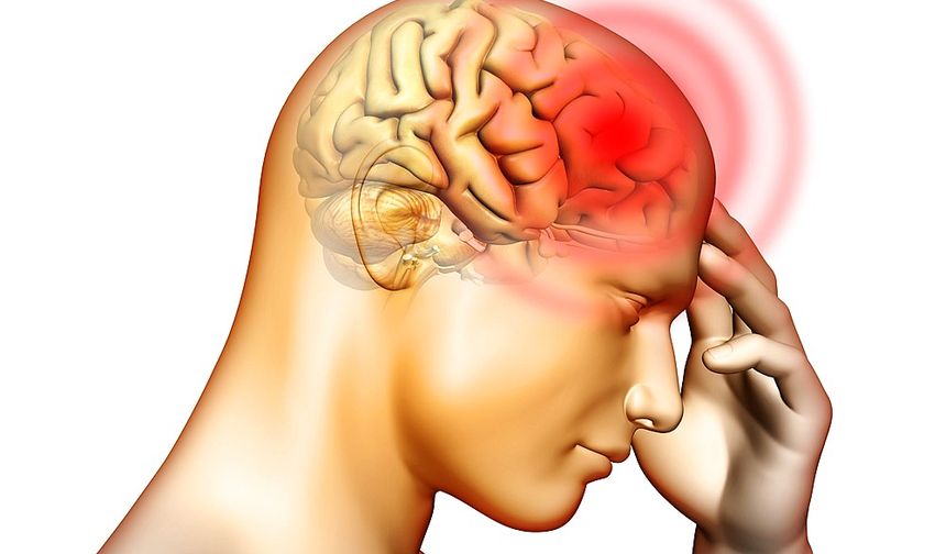 Beyin kanaması neden olur? Beyin kanaması nasıl önlenir?