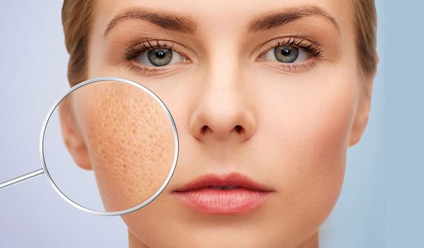 Kış Aylarında Cilt Alarm Veriyor