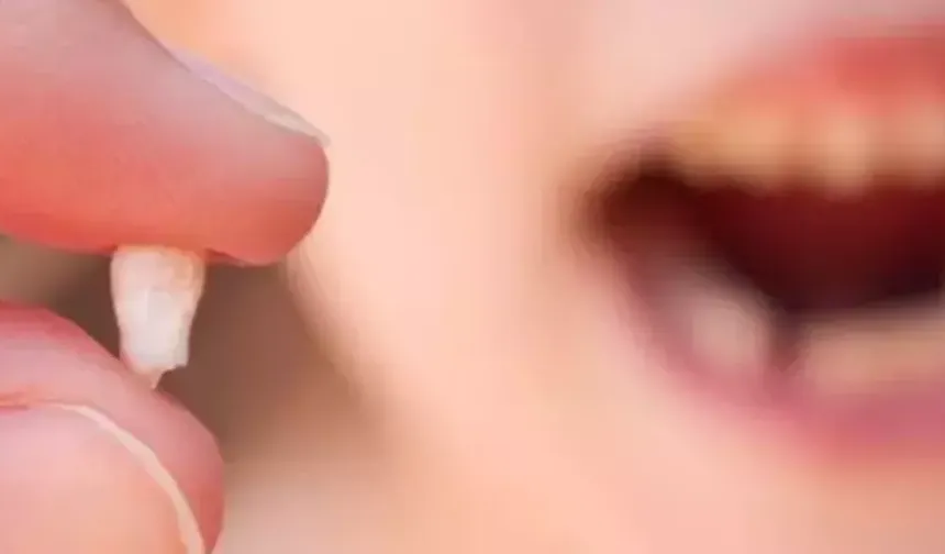 Rüyada Diş Düşmesi Ne Anlama Gelir?