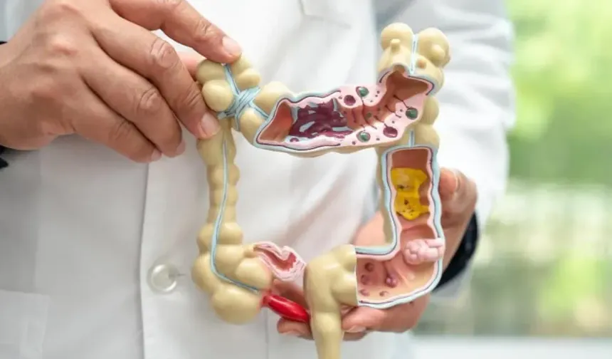 Bağırsak Hastalıkları Ciddi Riskler Taşıyor