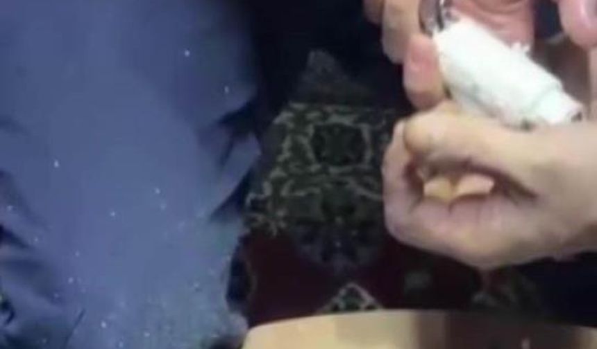 Parmağı Kombi Borusunda Kaldı