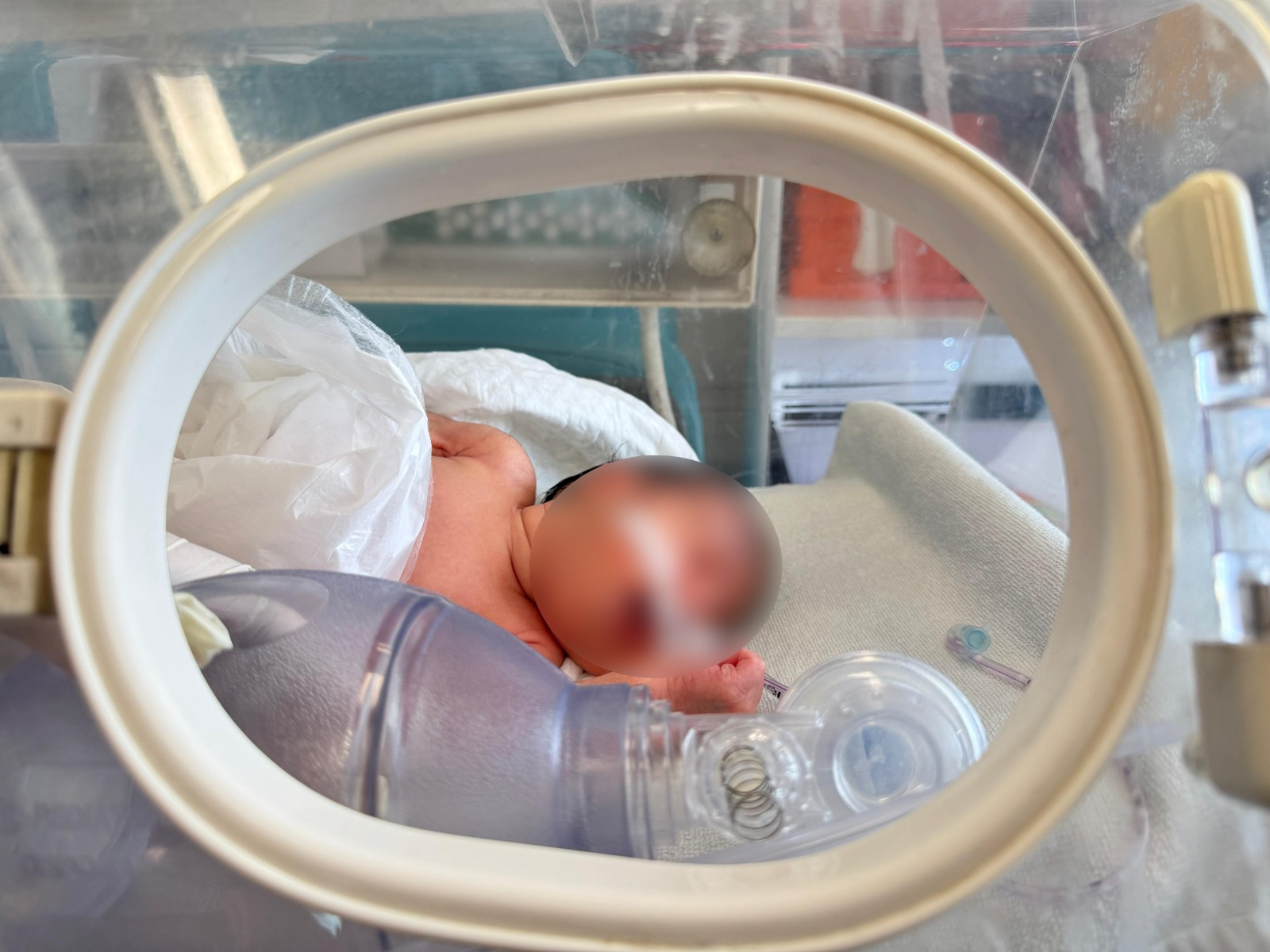 Prematüre Bebek (4)
